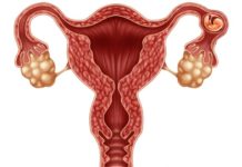 Mimoděložní těhotenství? O vejcovod přijít nemusíte, rozhoduje rychlá diagnostika