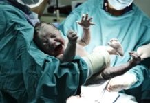 Císařský řez je nejčastější porodnickou operací. Kdy se provádí a jak zákrok probíhá?
