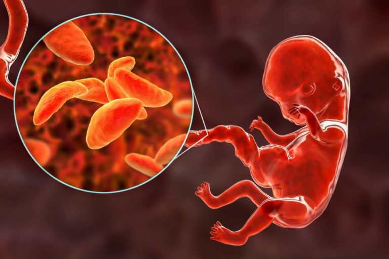 Jak se vyhnout toxoplazmóze v těhotenství? Základem je mytí rukou a tepelné zpracování masa