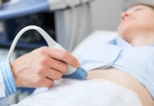 Edwardsův syndrom patří mezi nejčastější genetické poruchy. Šance na přežití dítěte jsou minimální edwardsuv syndrom_1